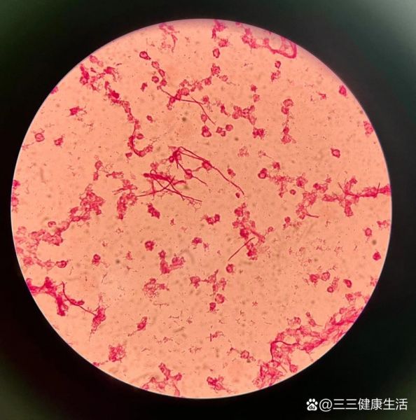 费格森，费格森埃希菌